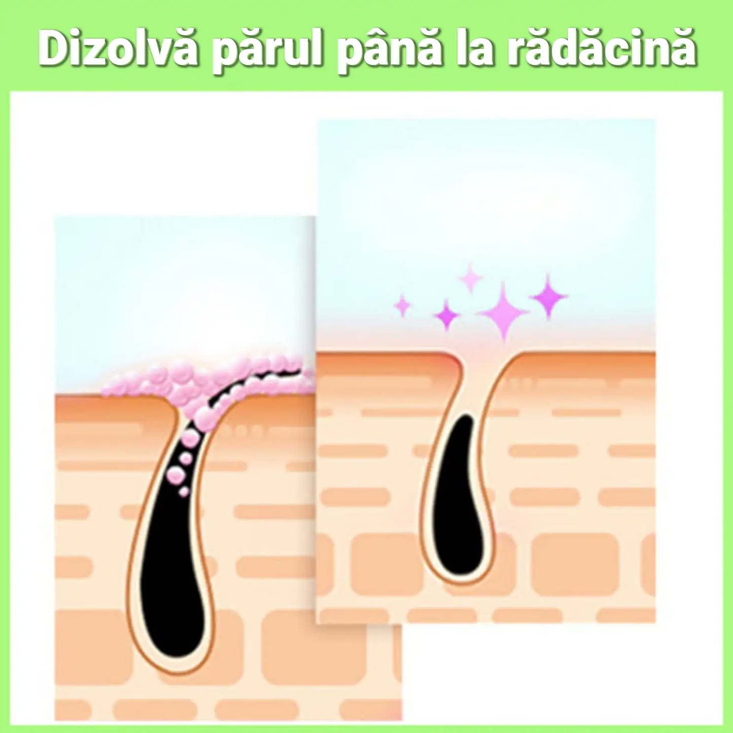 Spray Depilator Instant SHAWIX