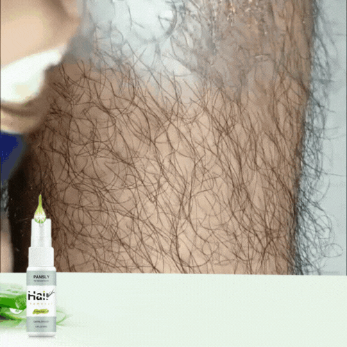 Spray Depilator Instant SHAWIX